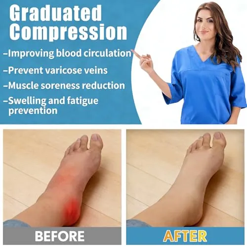 Sooverki Copper Compression Socks Review for Running & Work image 5