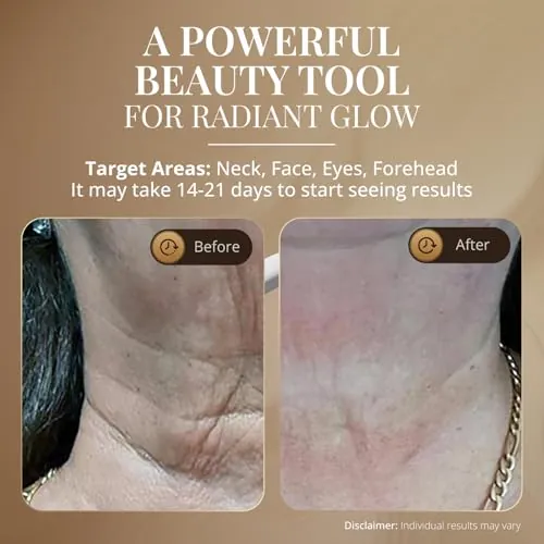 GLO24K Red Light Face & Neck Beauty Device Review image 4